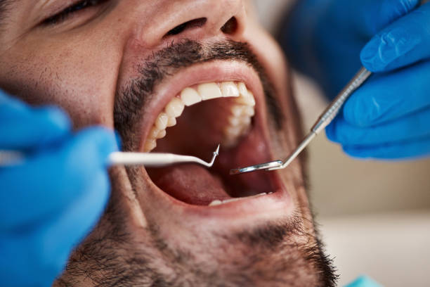Best Emergency Treatment for Oral Infections in Gates Mills, OH